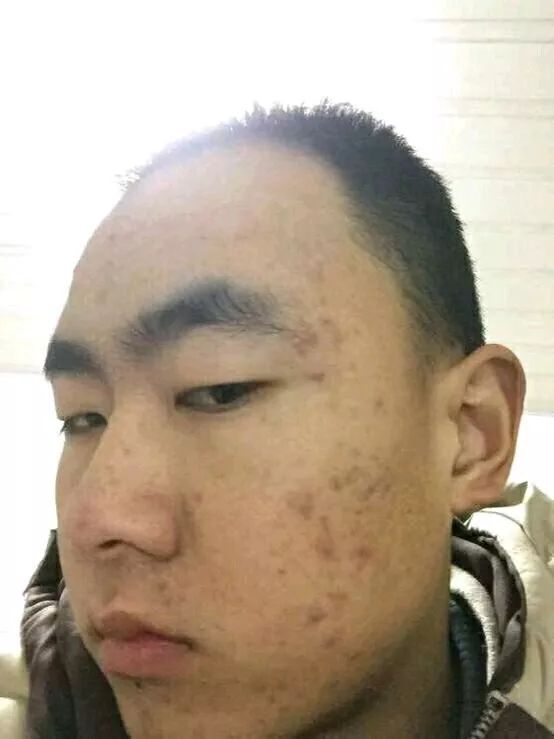 戒色233天毁容逆袭-图片1